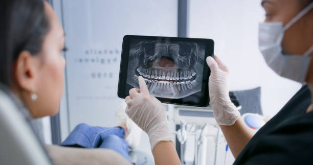 Licensed Teeth Whitening service in North Decatur, GA - Smile Center Dentistry